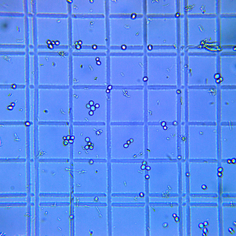 Lactobacillus 2.0 – Advanced Techniques for Fast Souring Beer