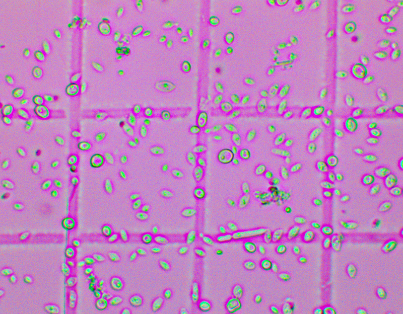 A variety of Brettanomyces cell sizes and morphologies can be seen in a 400x magnification of The Yeast Bay's Brussels Brett Blend.