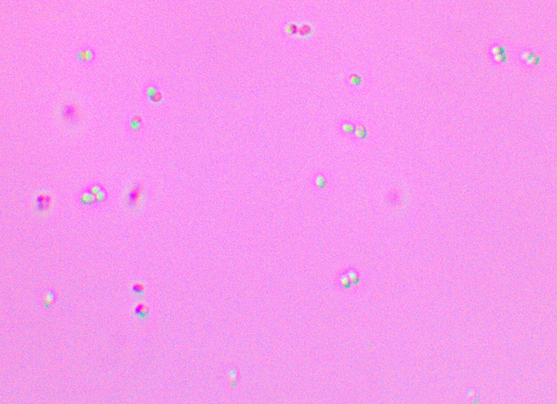 Pushing the limits of my microscope camera, Pediococcus cells can be seen forming clumps of 2 to 4 cells (tetrads) at 1000x magnification.