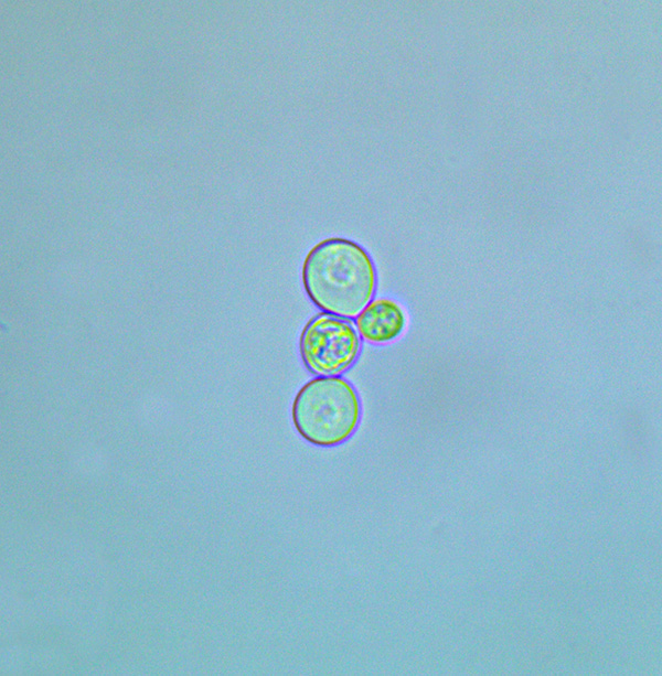 Saccharomyces cells under 1000x magnification. The two cells in the center are budding.